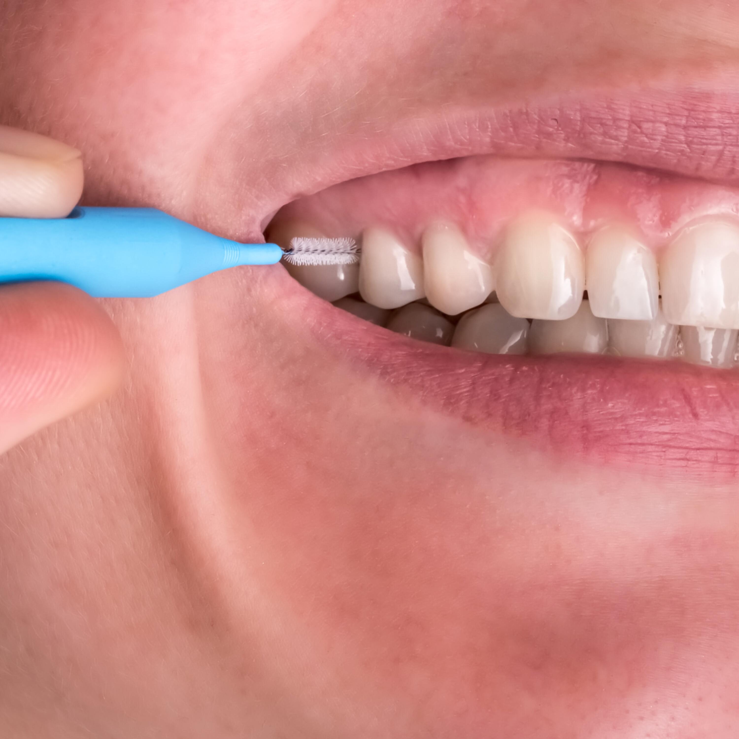 OC_ELGYDIUM CLINIC_Mono Compact_Interdental Brushes_Application_Teeth_3_2019_PL